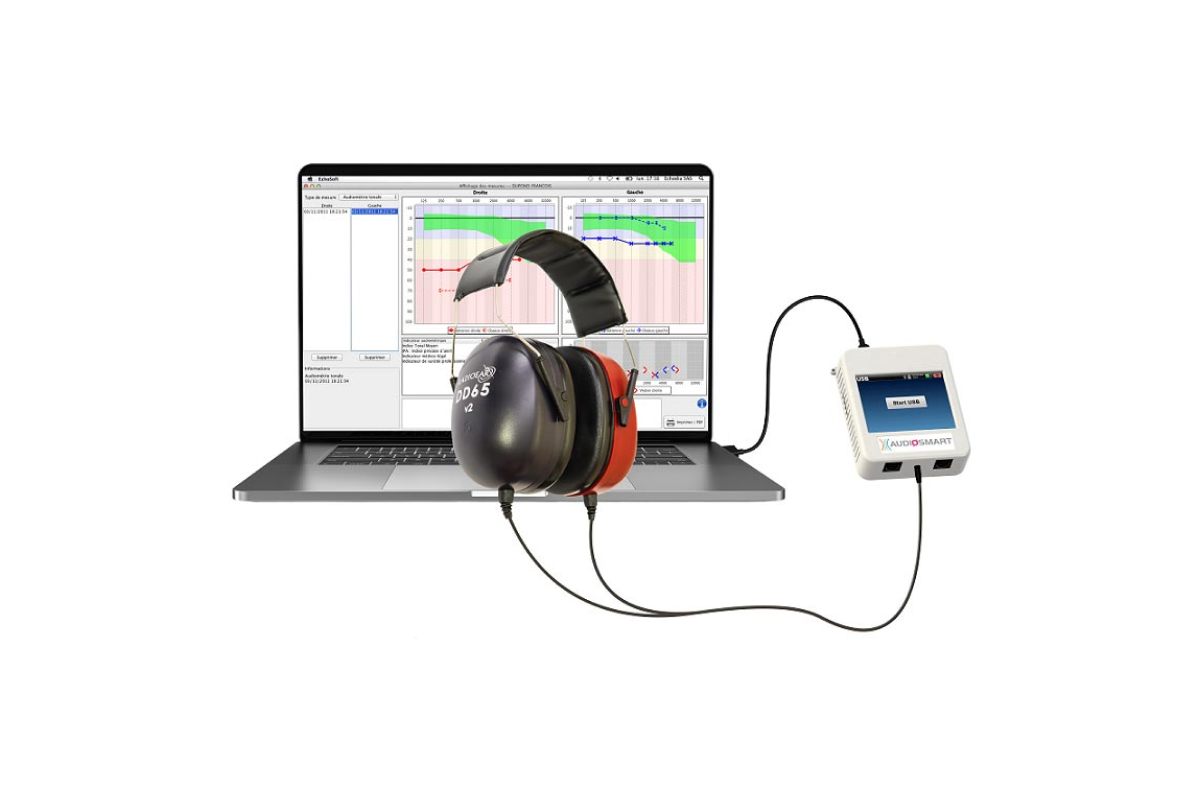 Audiosmart prezentacija