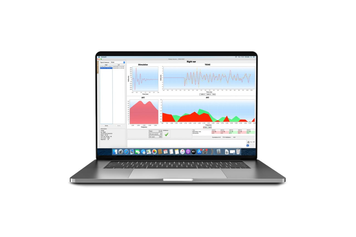 Babyscreen prezentacija